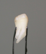 Зубы в газировке