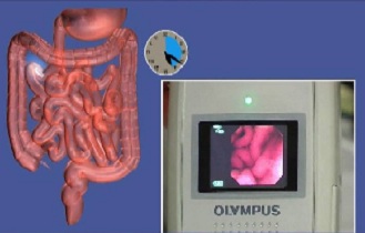 Эндоскопия 4